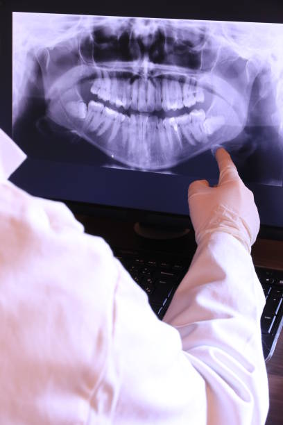 Best Emergency Root Canal Treatment in Leavittsburg, OH