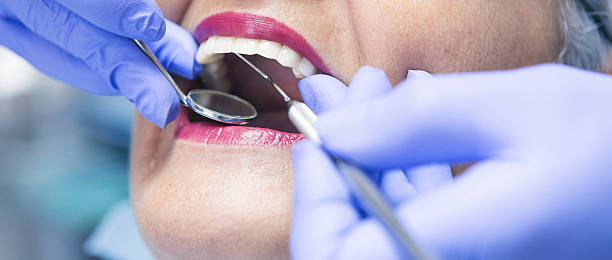 Best Emergency Tooth Extraction in Leavittsburg, OH