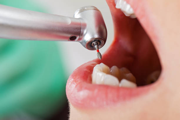 Best Pediatric Emergency Dentist in Leavittsburg, OH
